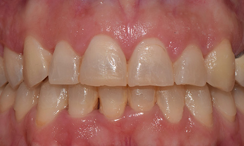 Estética dental (Diseño de sonrisas)
