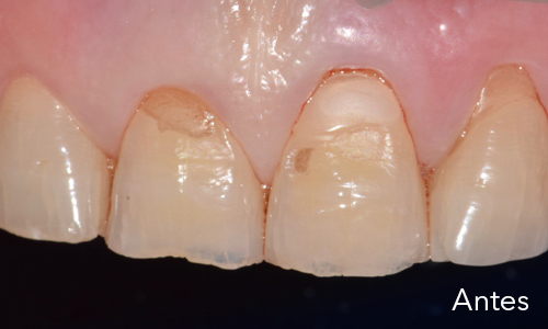 Periodoncia