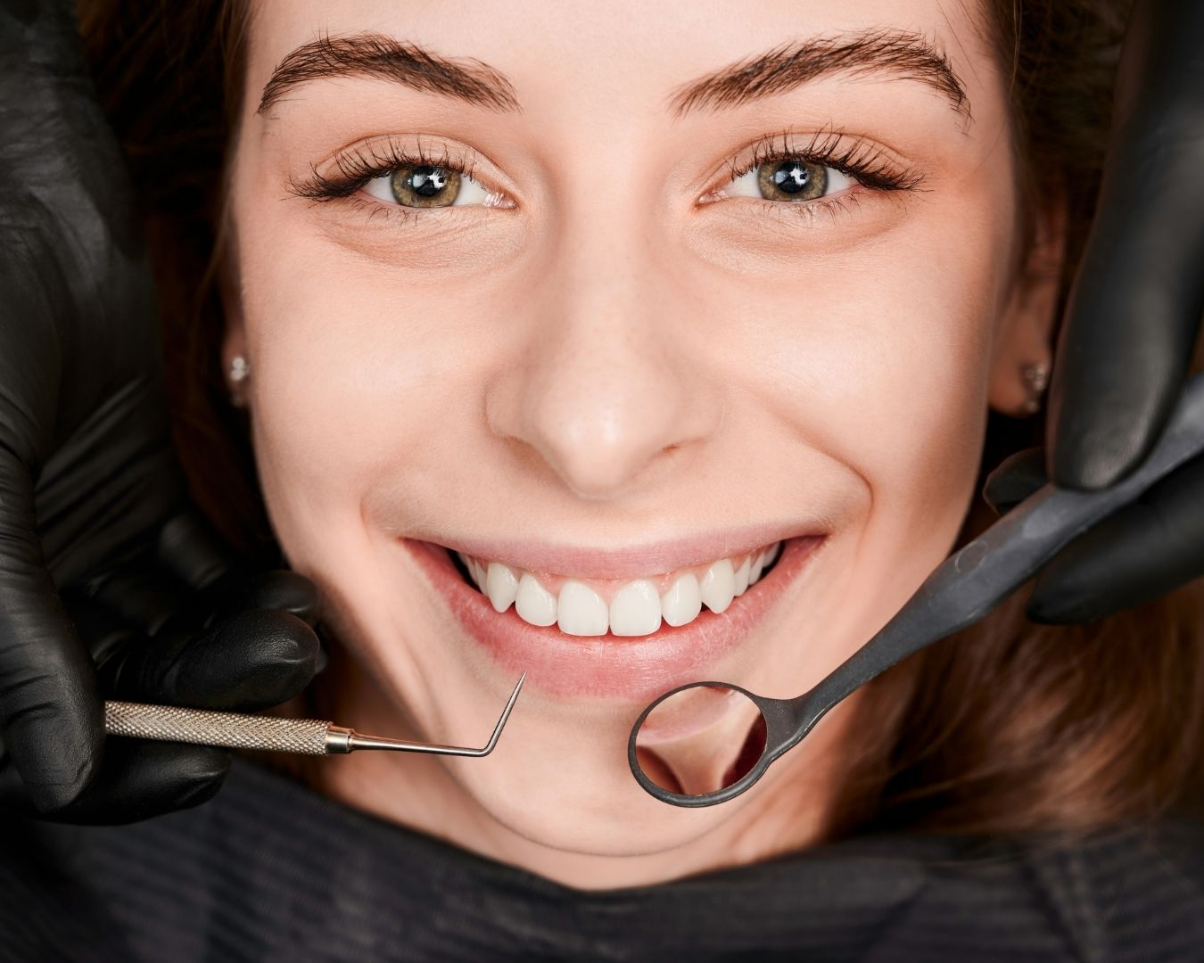 diseno-de-sonrisa-176