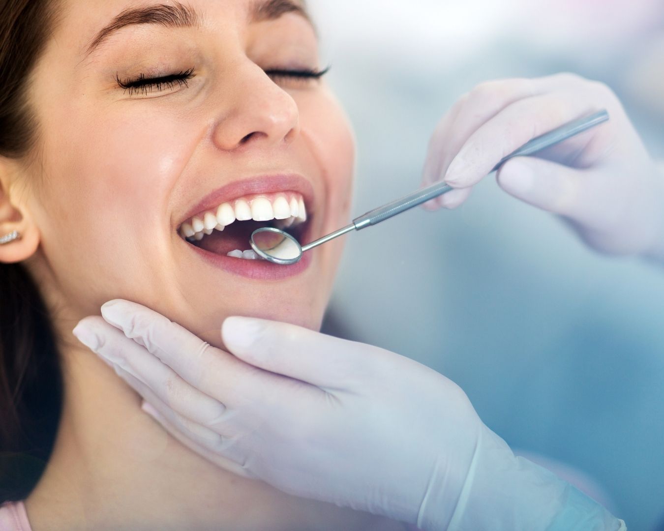 diseno-de-sonrisa-179