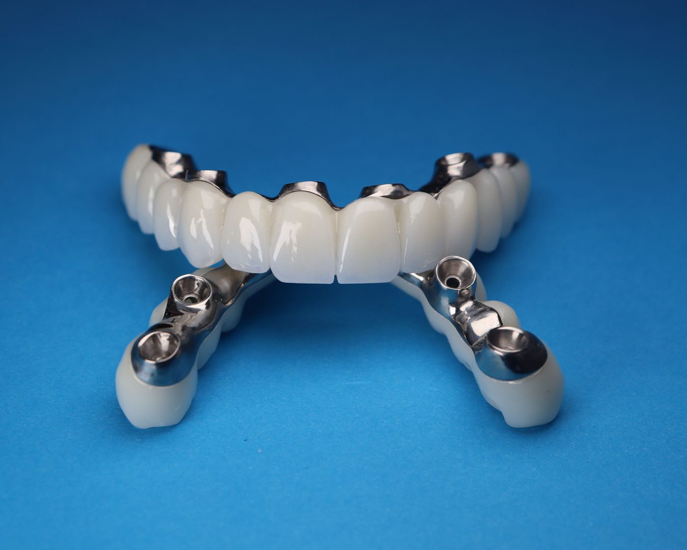 Prótesis fija All-on-6 sobre implantes Prótesis fija de arcada completa con sus pilares para implantes sobre fondo azul
