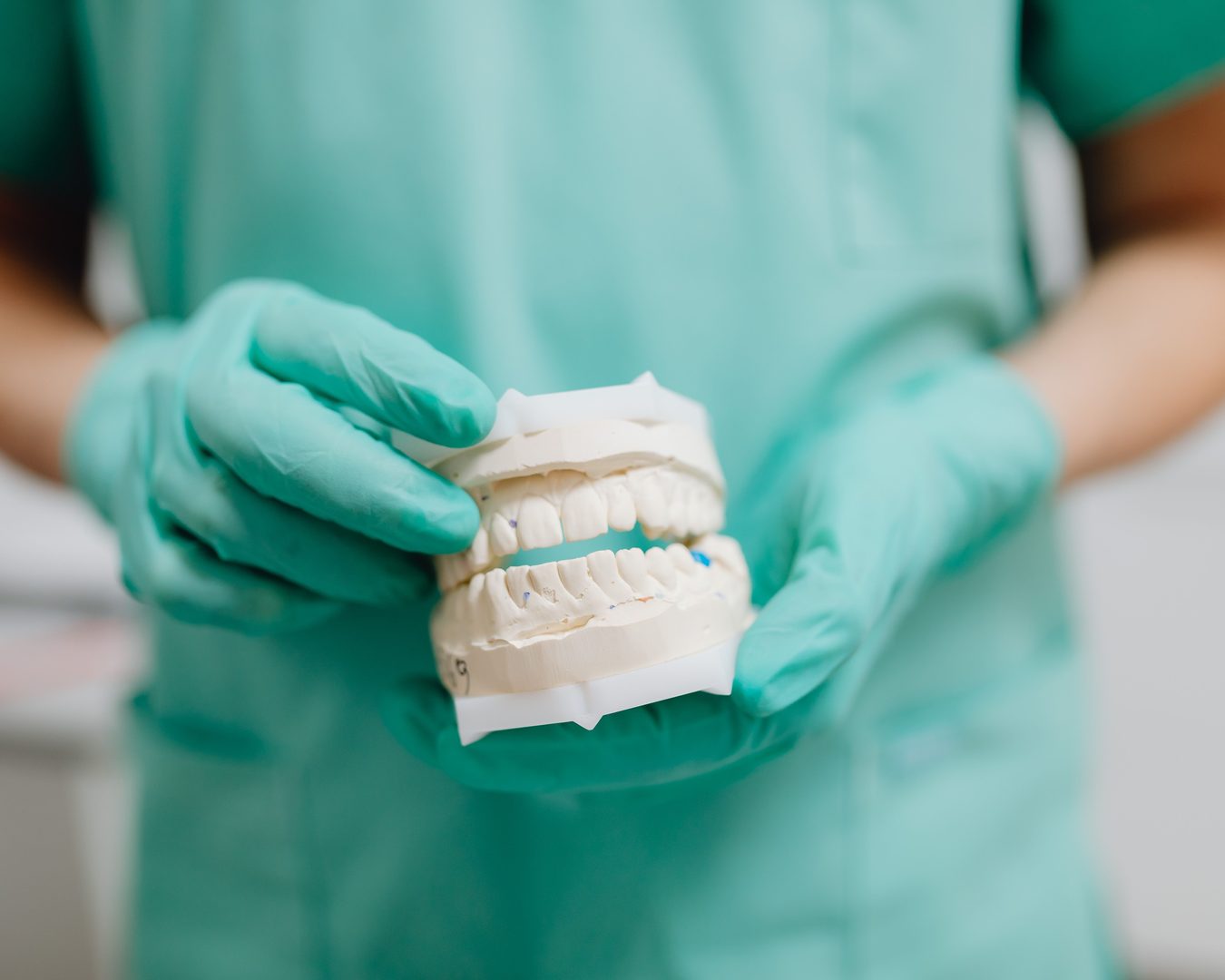 Tipos de prótesis dentales Profesional con guantes sostiene un modelo de escayola de una arcada dental